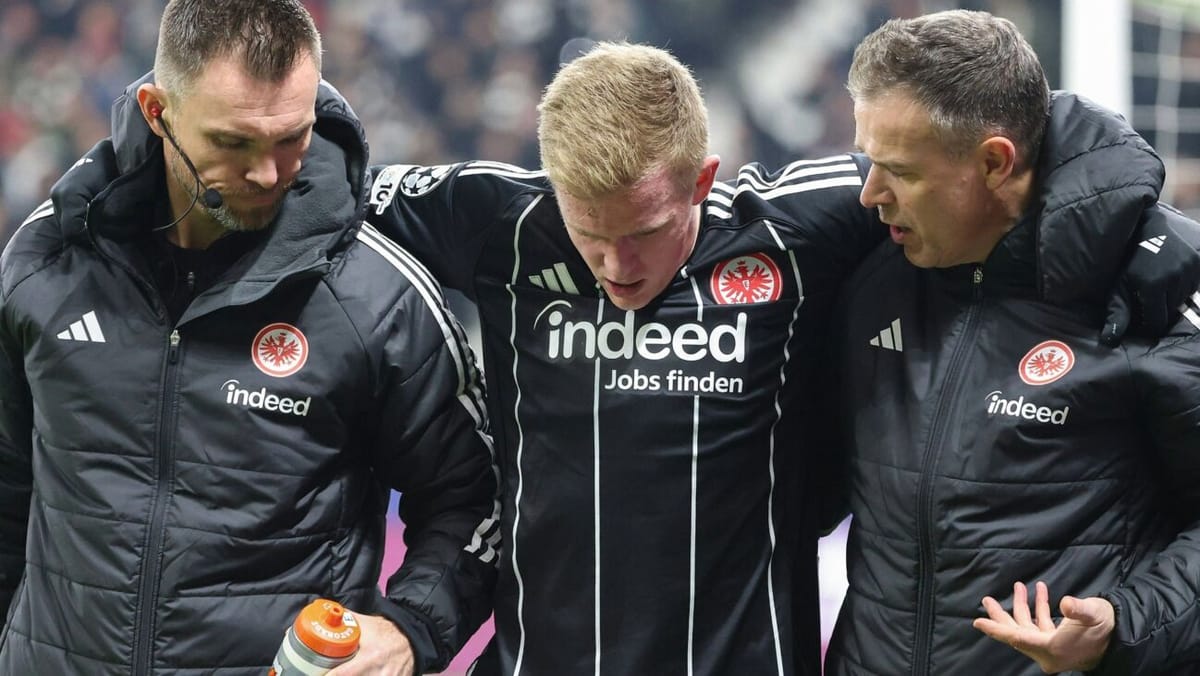 Toppmöller nach Burkardt-Ausfall: "Genug Optionen"