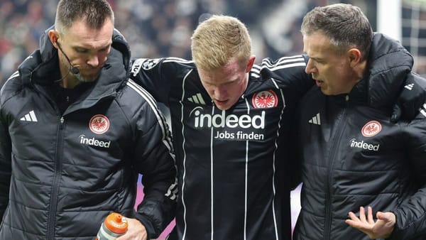 Toppmöller nach Burkardt-Ausfall: "Genug Optionen"