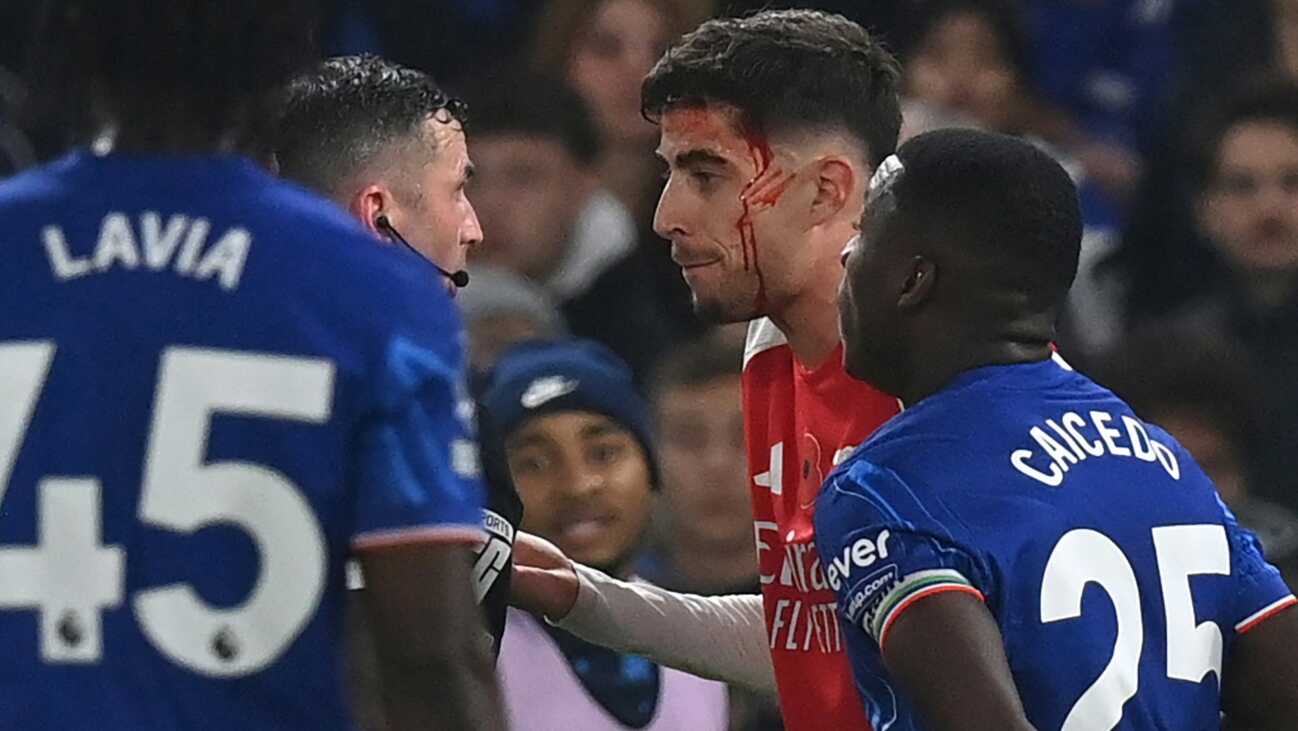 Mit blutendem Havertz: Arsenal verpasst Derbysieg Mit blutendem Havertz: Arsenal verpasst Derbysieg