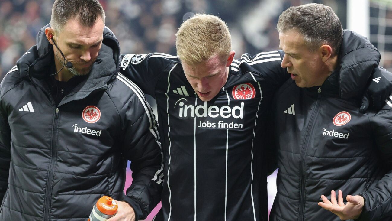 Toppmöller nach Burkardt-Ausfall: "Genug Optionen"